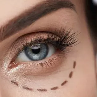 Eyelid    Surgery  